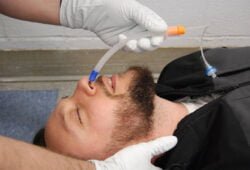 Naso-Flo® Nasopharyngeal Airway Device Naso-Flo® Nasopharyngeal Airway Device